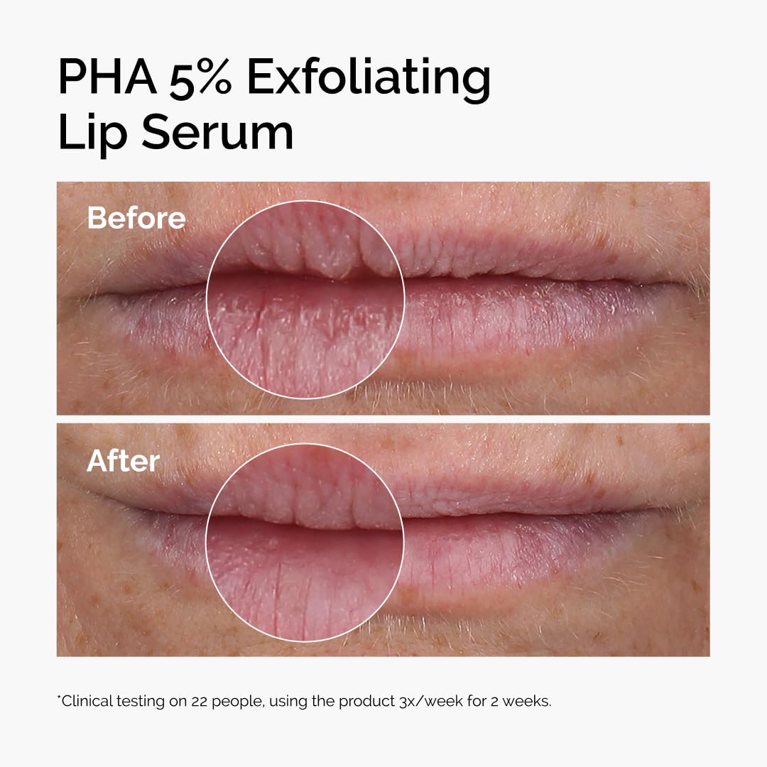 PHA 5% Exfoliating Lip Serum – Overnight Lip Treatment, 15 mL