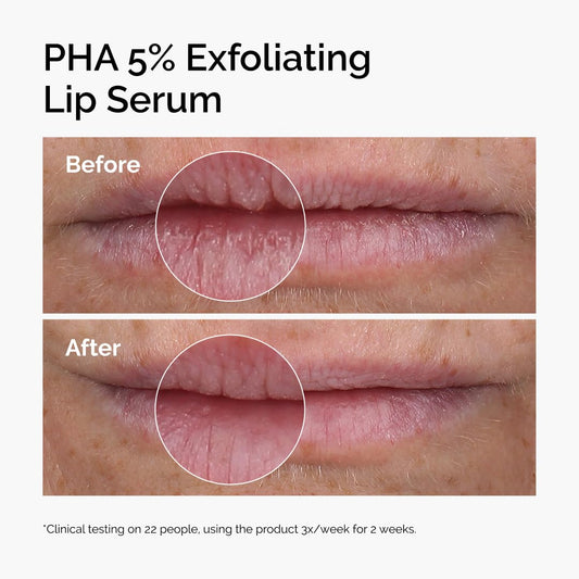 PHA 5% Exfoliating Lip Serum – Overnight Lip Treatment, 15 mL