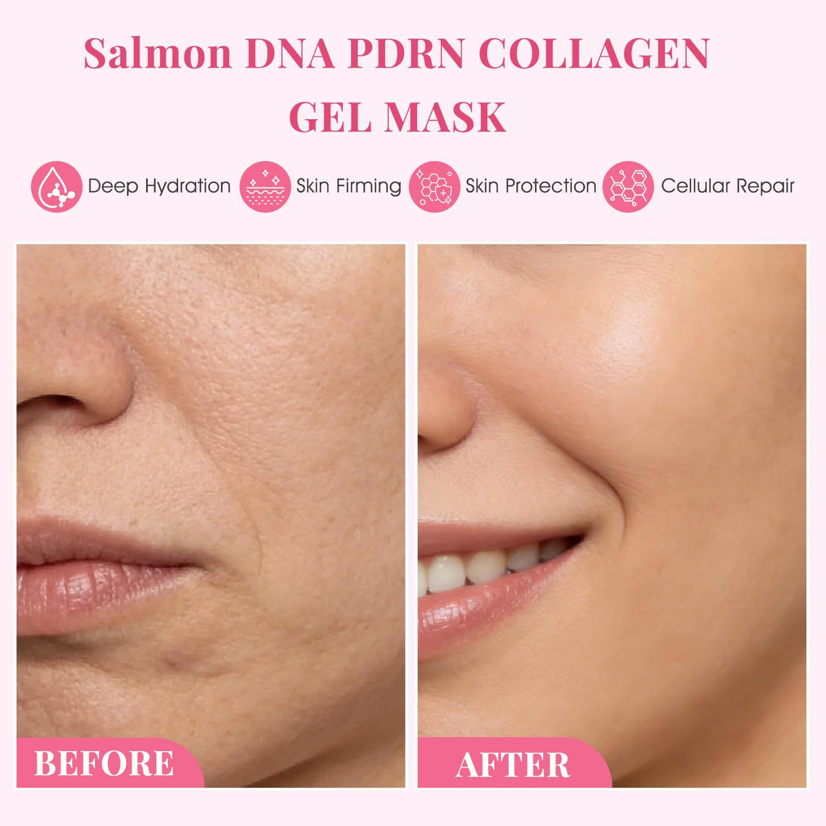 PDRN Deep Repair Gel Face Masks – 6 Pack