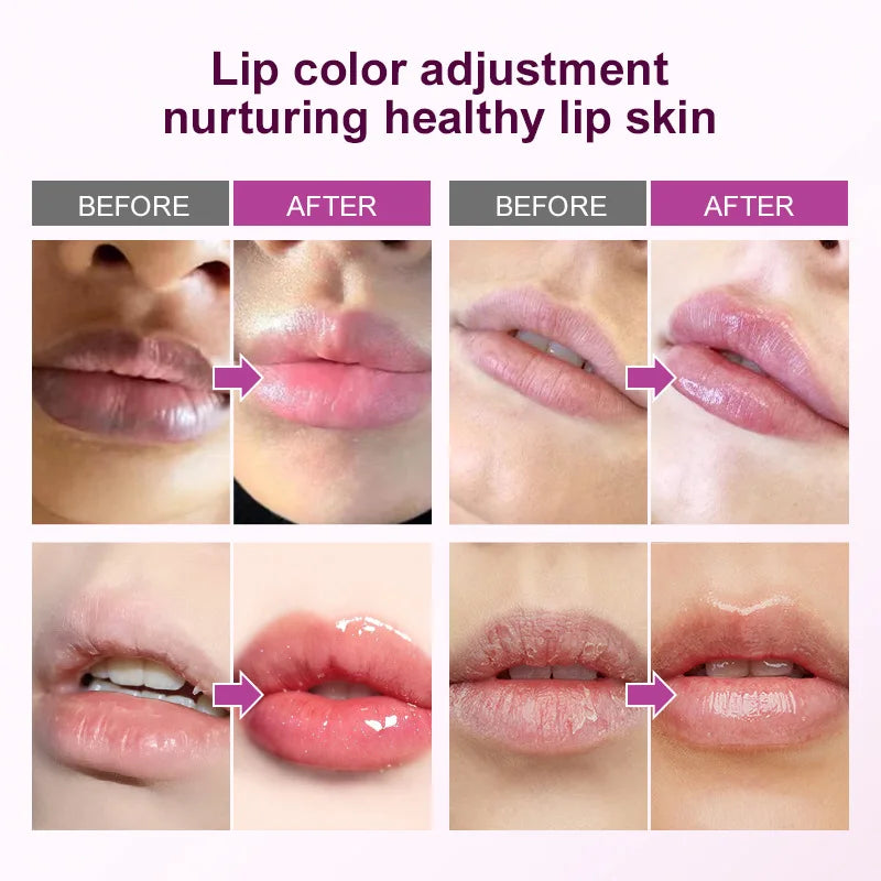 Brightening Lip Treatment Balm