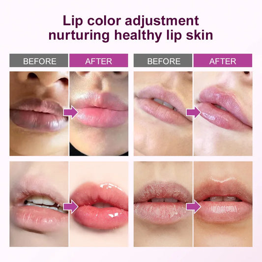 Brightening Lip Treatment Balm